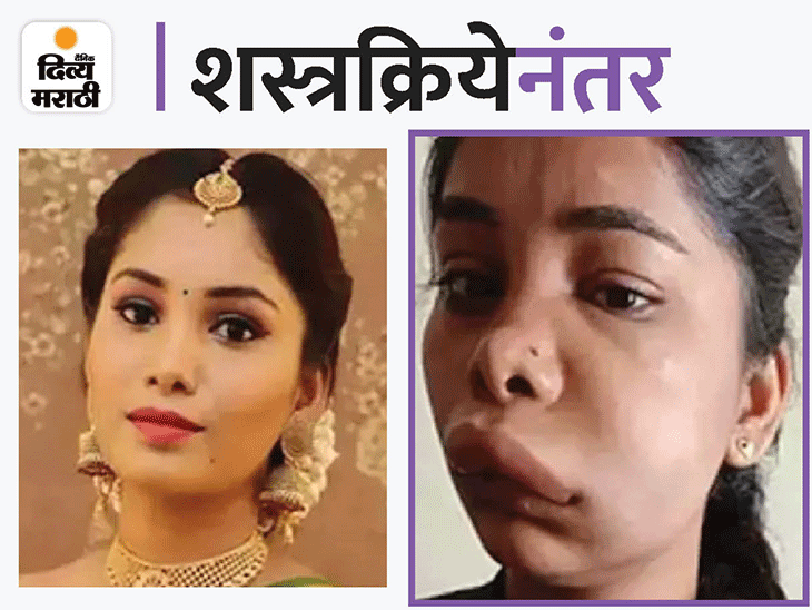 Kannada Actress Swathi Sathish’s Root Canal Surgery Goes Wrong, Looks