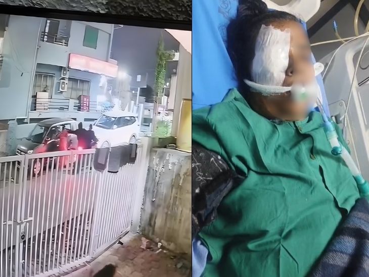 छत्रपती संभाजीनगरात चेन स्नॅचिंगचा थरार:  हिसका बसून पडल्याने महिलेच्या डोळ्याला गंभीर दुखापत; दोन महिन्यांत 5 घटना – Chhatrapati Sambhajinagar News