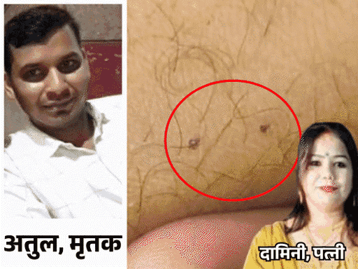 पत्नीने पतीला सर्पदंश देऊन ठार मारले:  मेरठमध्ये सकाळी मृतदेह घेऊन रुग्णालयात पळाली, दुधात झोपेच्या गोळ्या दिल्या, लव्ह मॅरेज होते