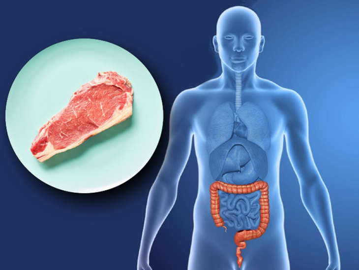 How Red Meat Consumption Is Linked To Colorectal Cancer Shown For First ...