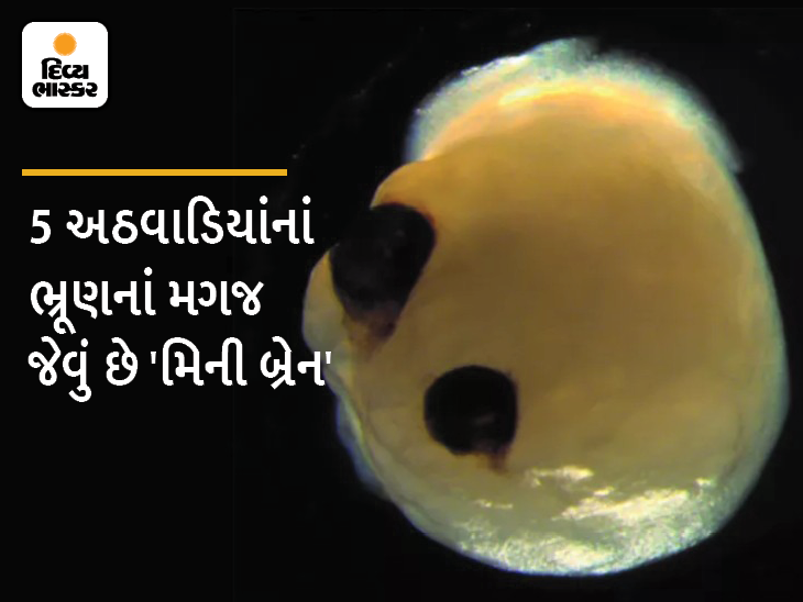 Lab made Mini Brains Grow Their Own Sets Of Eyes That Can Detect Light