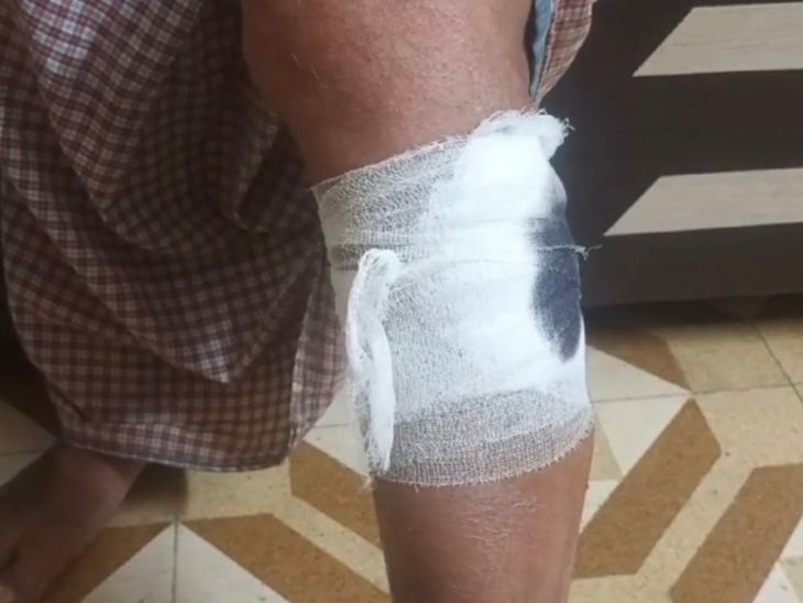 9 people in two societies were children; The injured were shifted to ...
