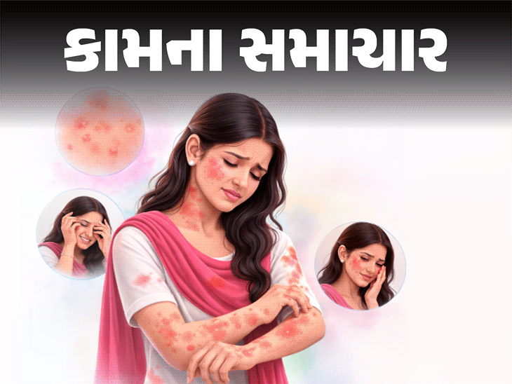 Dermatologist Tips: 10 Home Remedies for Skin Rash After Holi Colors