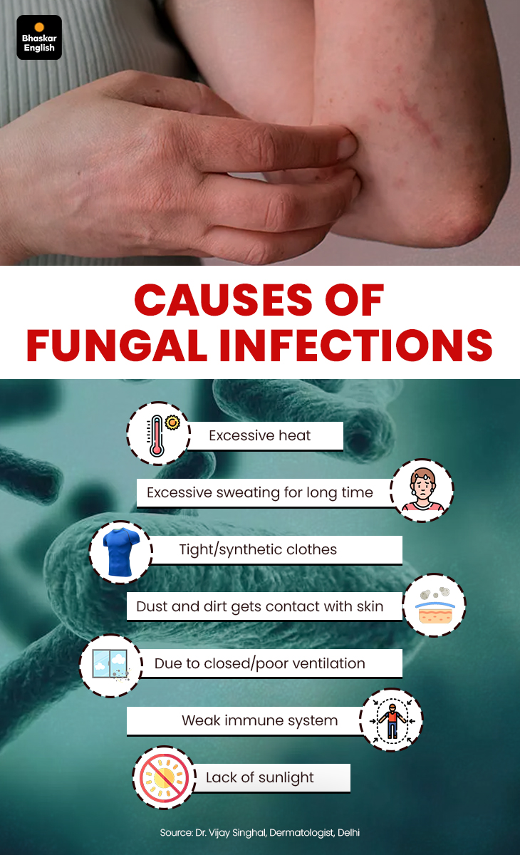 Persistent Fungus Rash Fungal Skin Rashes Causes