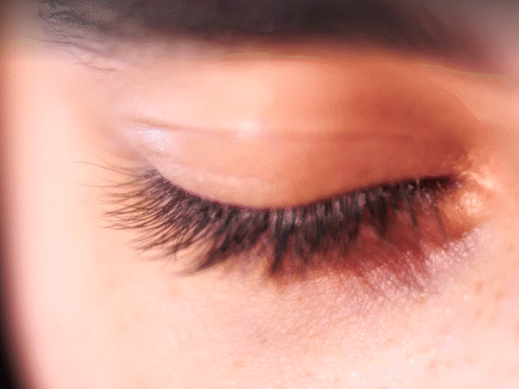 Monsoon Eye Infection Problems Stye Conjunctivitis Symptoms | Bhaskar  English