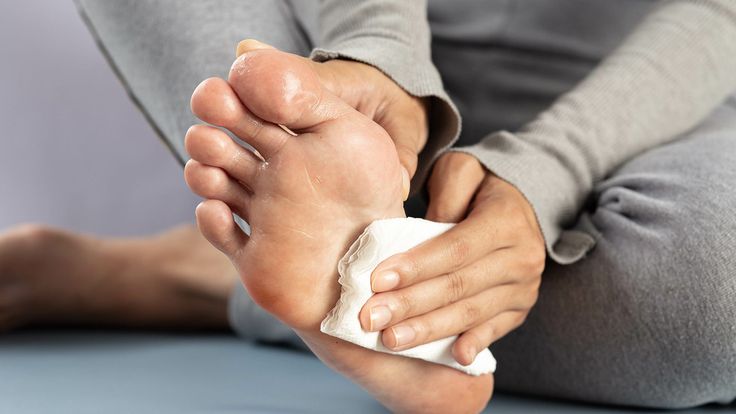 Monsoon Alert- Protect your feet from fungal infections