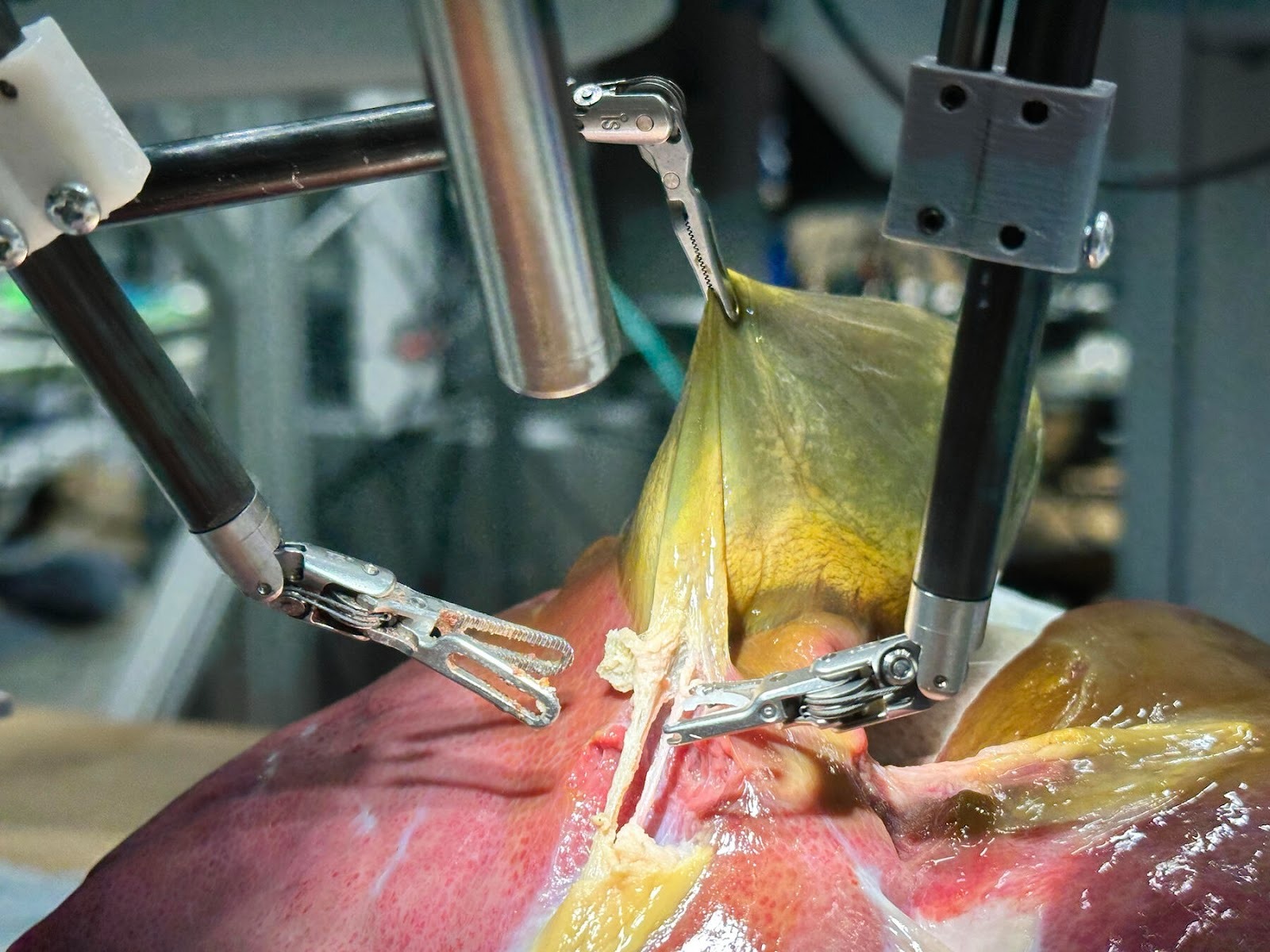 An AI robot named SRT-H performing gallbladder surgery in a laboratory at Johns Hopkins University. (Photo: John Hopkins University)