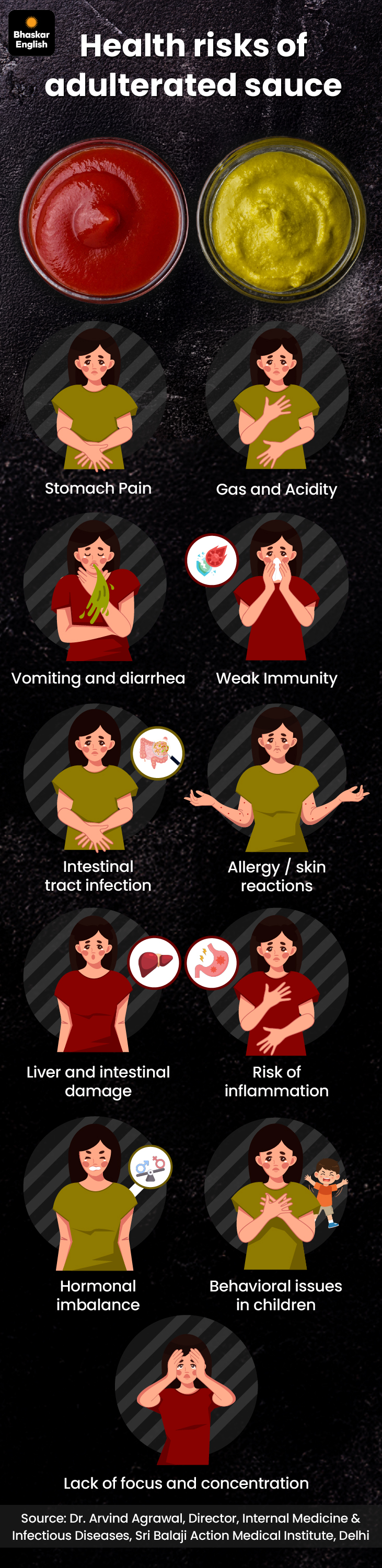 Doctors Advice: Avoid Street Food, Spot Adulterated Sauce at Home | UP News