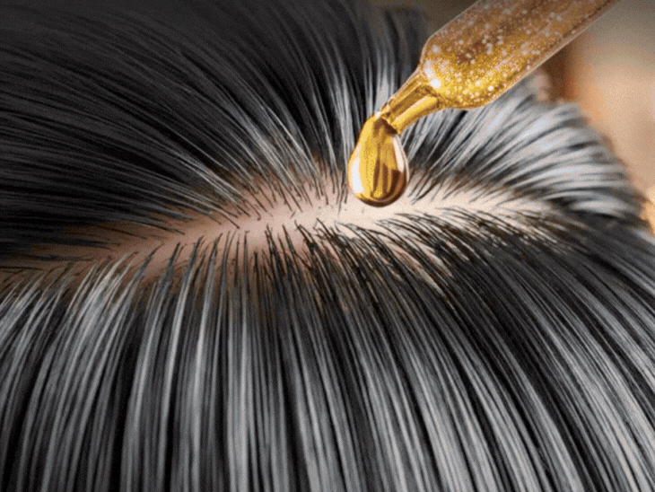 Dermatologist Hair Protection Tips | Oiling Hair & Dandruff
