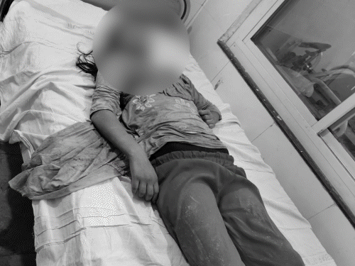 रायसेन के इसी कुएं में हुआ हादसा. - भास्कर इंग्लिश