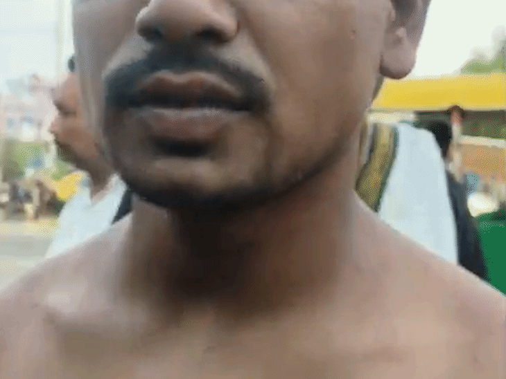 युवक के चेहरे पर पिटाई के निशान हैं।