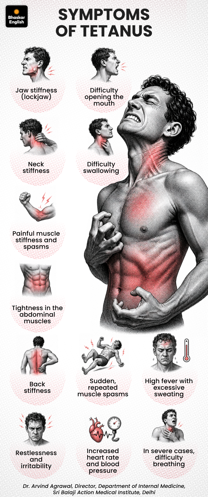 Tetanus Injuries Tetanus Prevention: 10 Doctor Tips for Injury Risk