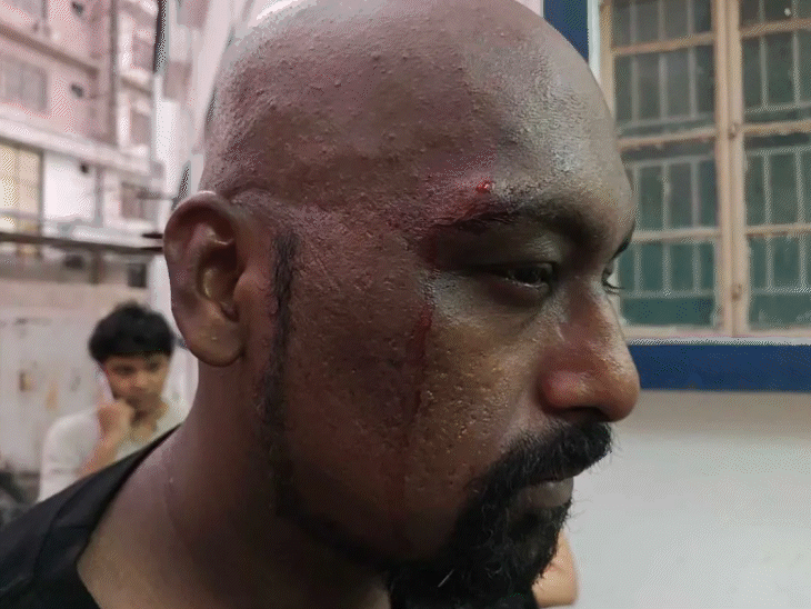 Participants who suffered injuries