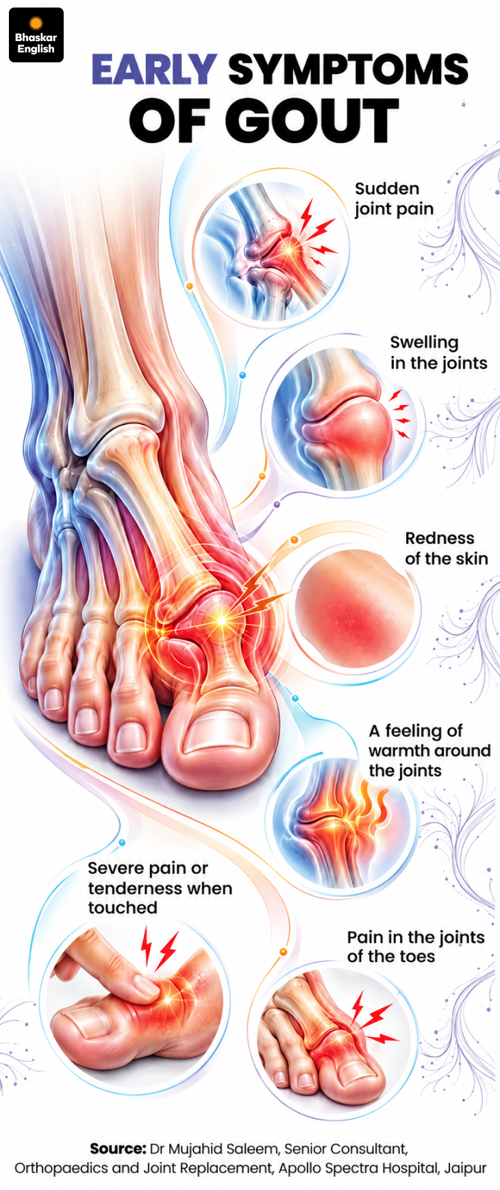 Global Gout cases set to reach 95.8 million by 2050 men face higher risk