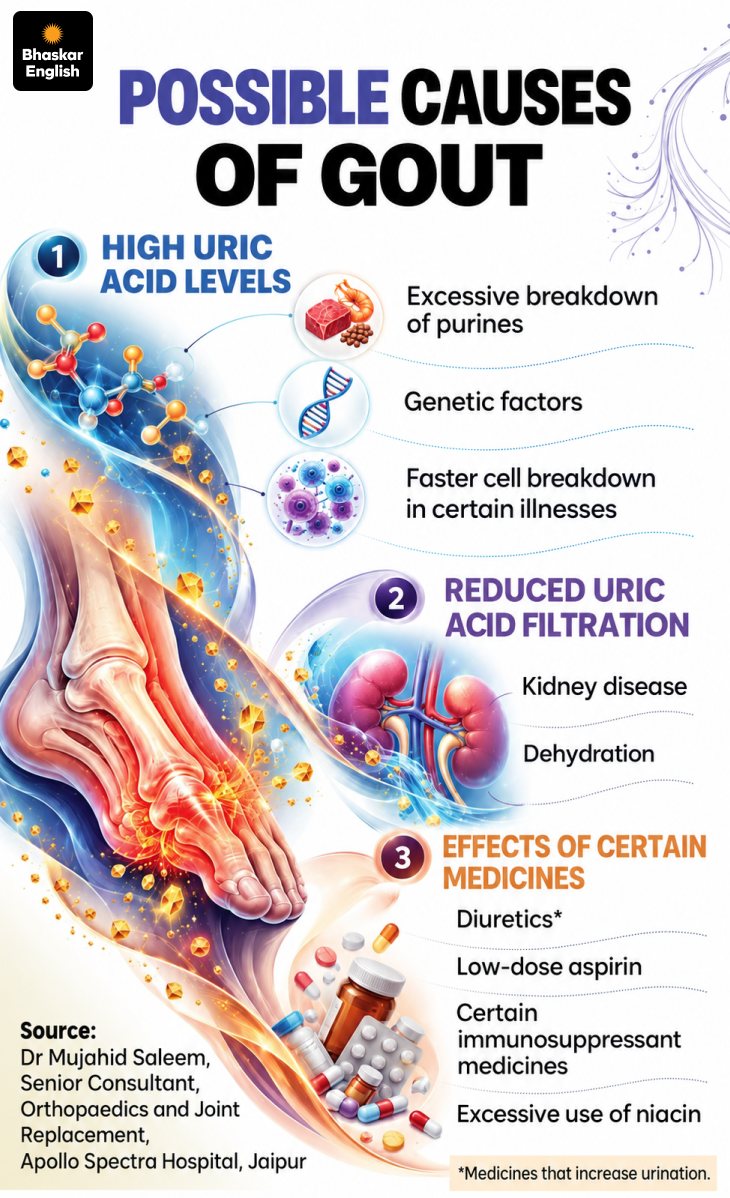 Global Gout cases set to reach 95.8 million by 2050 men face higher risk