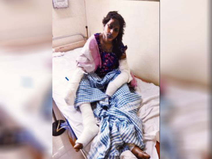 खाना बनाने किचन में गई थी महिला, लाइटर जलाते ही हो गया ब्लास्ट; हादसे में तीन मासूम समेत 5 लोग झुलसे|गुजरात,Gujarat - Dainik Bhaskar