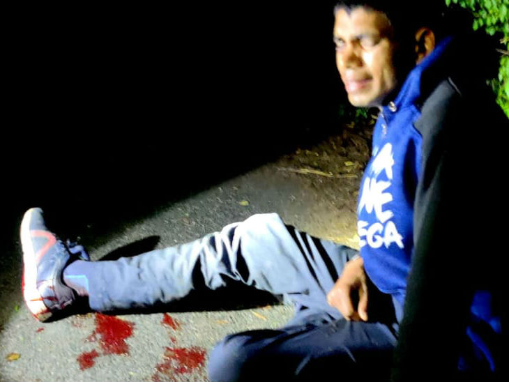 पुलिस पर फर्जी एनकाउंटर करने का आरोप लगाकर घायल युवक के परिजन धरने पर बैठे, एसपी ने जांच का भरोसा दिया|कानपुर,Kanpur - Dainik Bhaskar