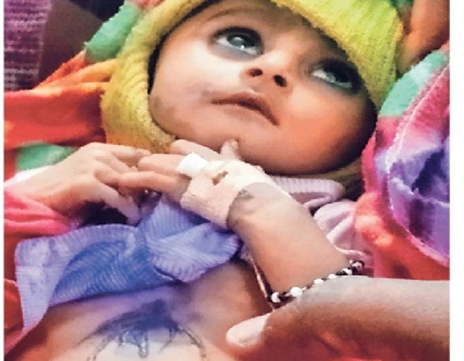 मासूम स्वरूप को छह जगह चिमटे से दागा गया। - Dainik Bhaskar