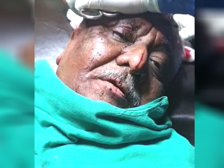 गोलीकांड में जीवित बचे राकेश जैन ने पुलिस को बताया घटनाक्रम। - Dainik Bhaskar