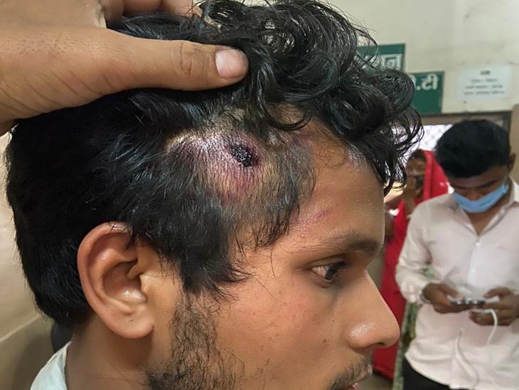 युवक के सिर पर भी चोट आई है।