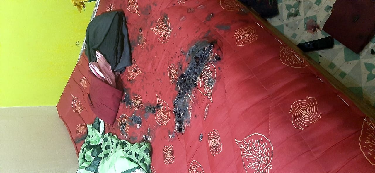 एसिड के कारण गद्दा भी जल गया।