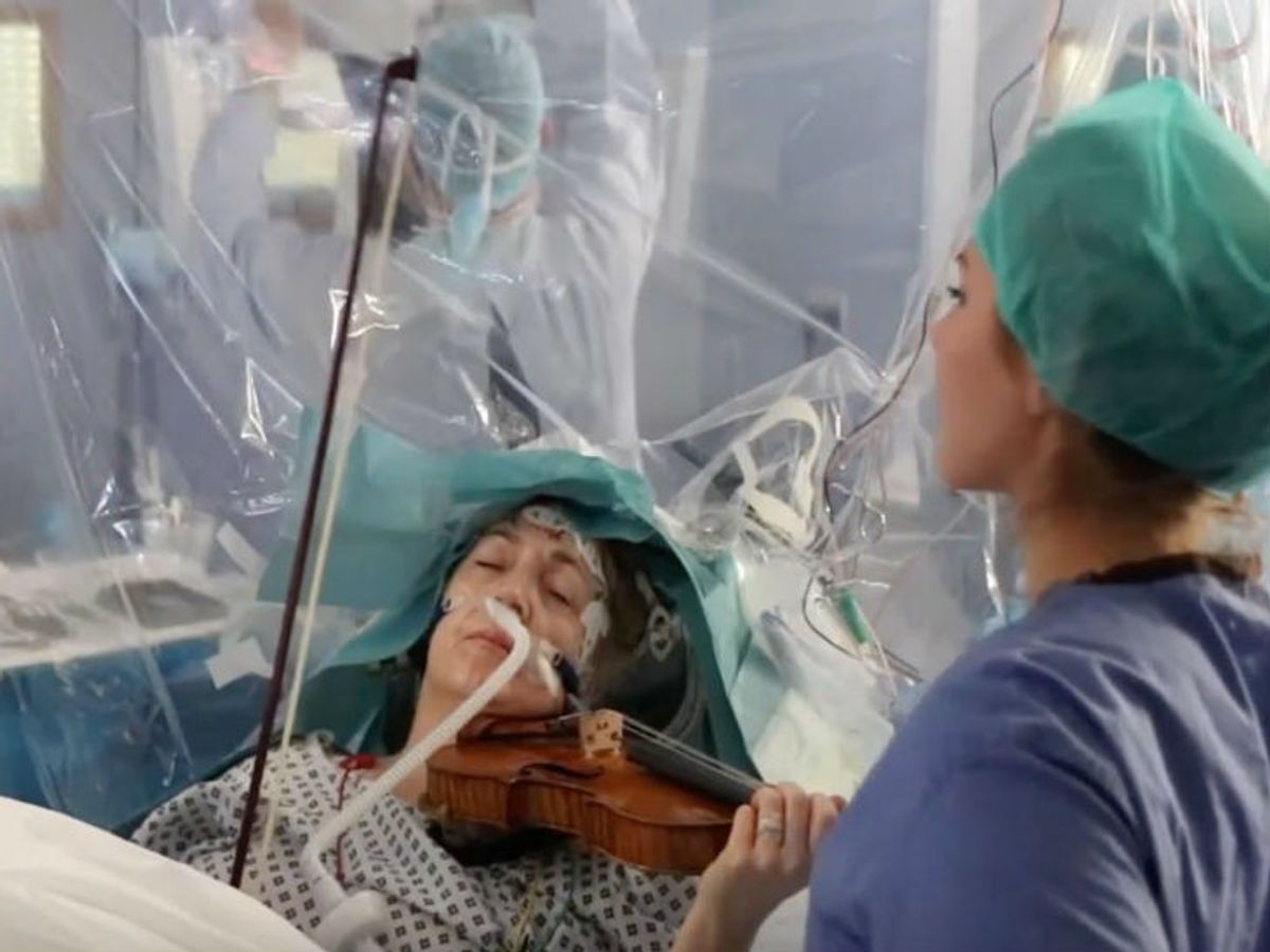 करीब 9 महीने पहले 53 वर्षीय टर्नर की ब्रेन सर्जरी हुई। इस दौरान उन्होंने वायलिन बजाया।