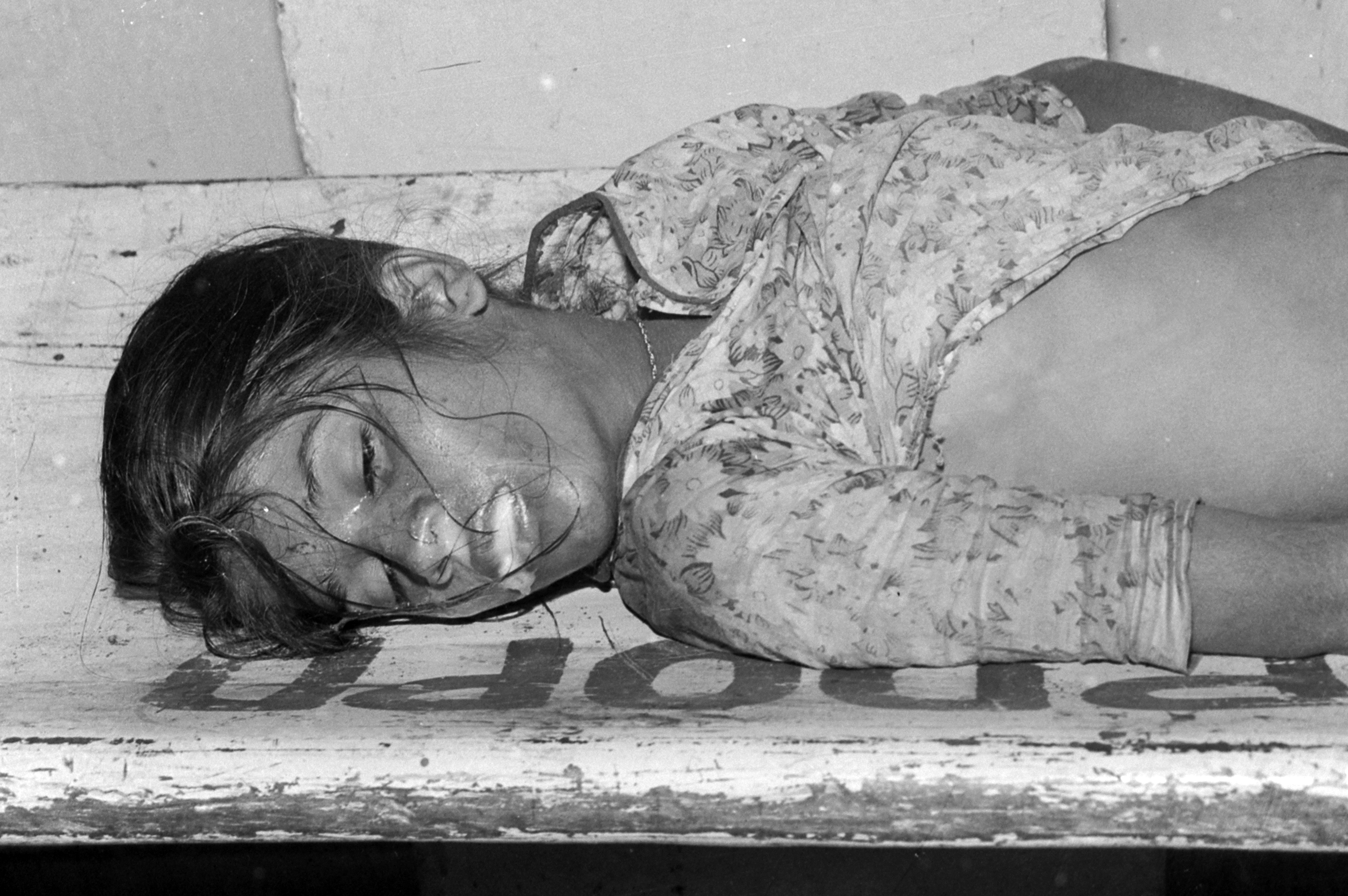 गांधी मेडिकल कॉलेज पहली लाश जो एक लड़की की आई। इसके मुंह से निकल रहा था झाग।