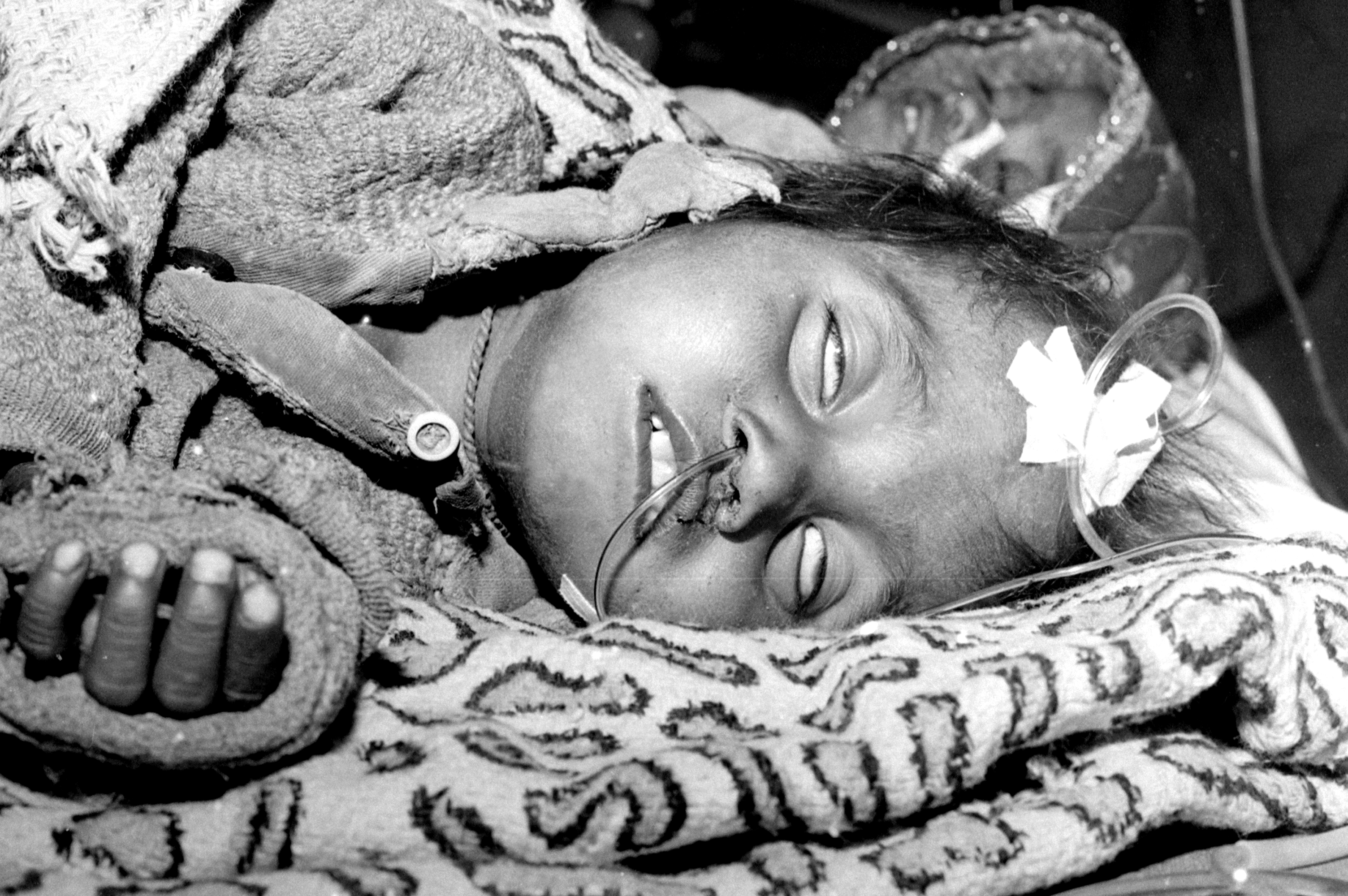 जहरीली गैस ने बच्चों के फेफड़े से लेकर आंखों तक किया गहरा असर।