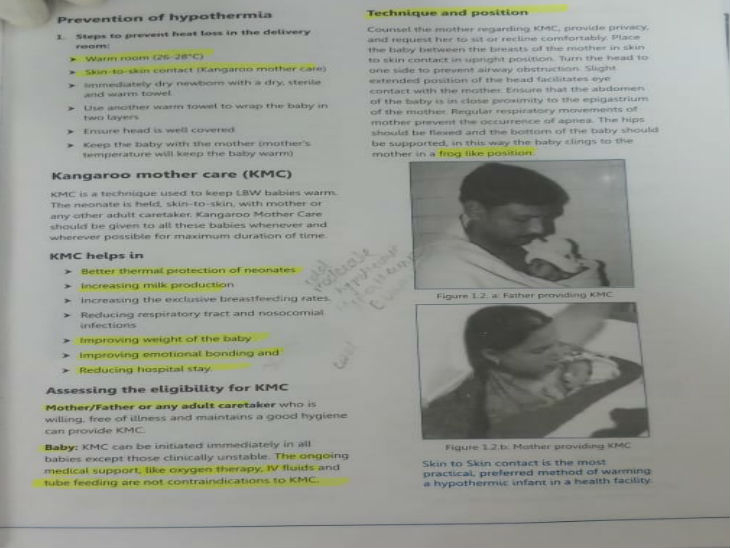 केएमसी (कंगारू मदर केयर) का ये है बेहतर तरीका