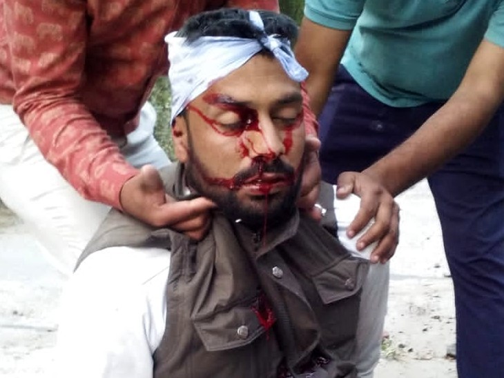 हादसे में घायल भूपेंद्र सिंह को लोगों ने अस्पताल पहुंचाया, जहां डॉक्टरों ने उसे मृत घोषित कर दिया।