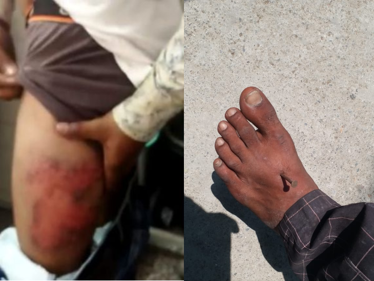 3 stories of UP police's raid: Nail in Bareilly wearing a mask in his hands  and feet; In Rae Bareli, 5 youths were kept in the post and beaten  overnight, and in