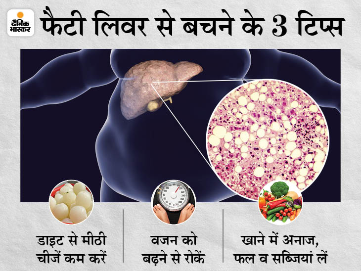 Fatty Liver Symptoms; Kya Hota Hai, What Is and Precautions? All You