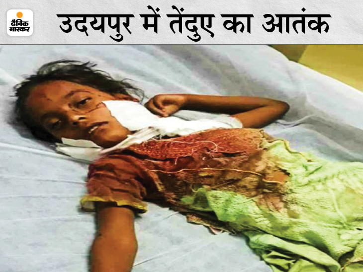 5 साल की बच्ची पर तेंदुए ने किया हमला: आंगन से मुंह में दबाकर ले जाने लगा, तभी माता-पिता ने तेंदुए से लड़कर बचाई बेटी की जान