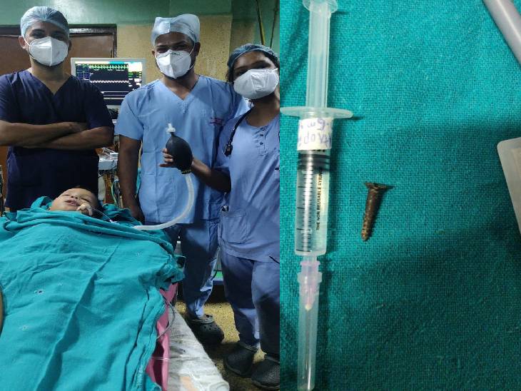 Doctors of Jabalpur Medical College removed the screw stuck in the