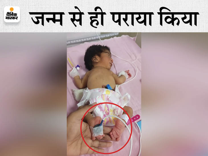The girl child born with both legs inverted from the knee, the parents ...