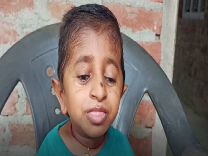 रमजान अपने हाथों से अपना कोई काम नहीं कर पाते है।