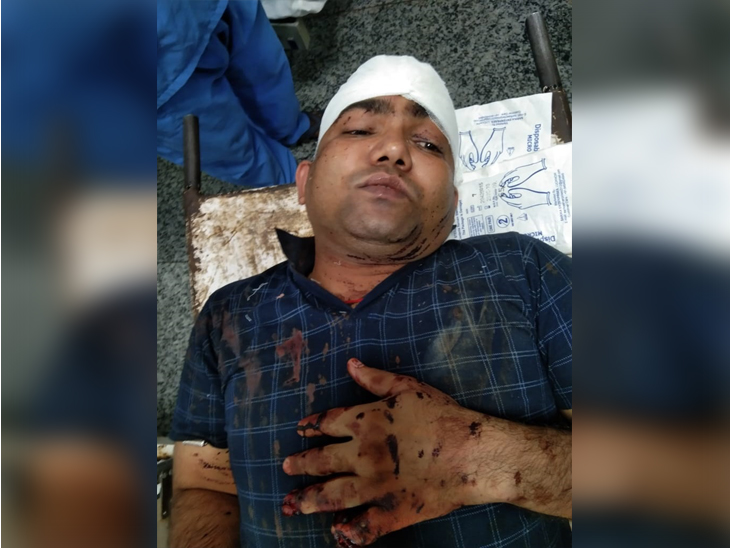 चौरीचौरा इलाके के तरकुलहा के पास हुए हमले में उनके सिर पर गंभीर चोट आई है। जबकि बाएं हाथ की दो अंगुलिया भी हमलावरों ने काट दी है। - Dainik Bhaskar