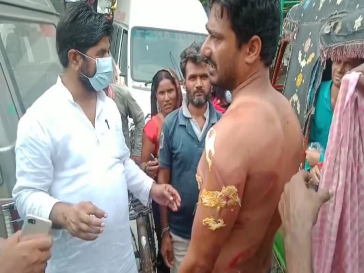 जमीनी विवाद में घायल हुआ व्यक्ति. - Dainik Bhaskar