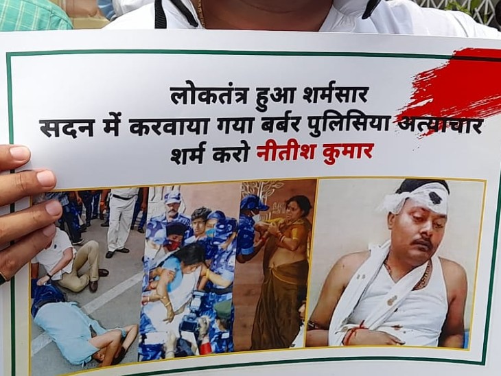 बजट सत्र में हुई मारपीट की फोटोज लेकर पहुंचे राजद विधायक।