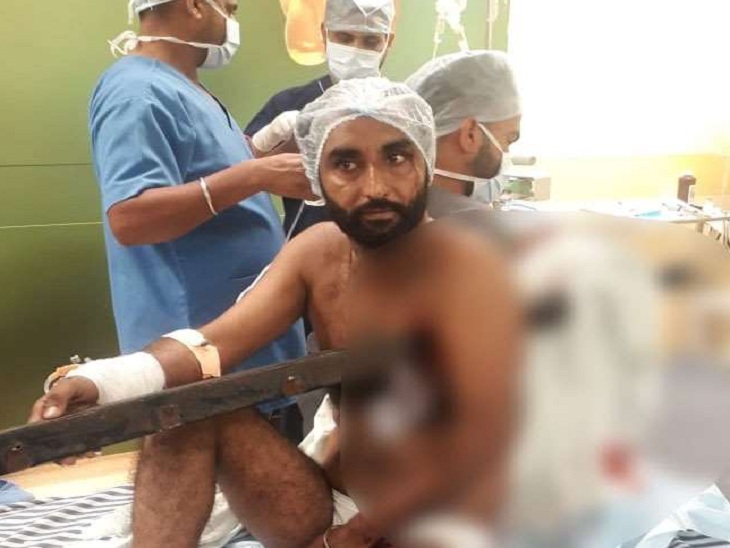 A rod passed through the chest of a man in bathinda of punjab, Doctors removed after 4 and a half hours of operation | डॉक्टरों ने साढ़े 4 घंटे चले ऑपरेशन के बाद 6 फीट लंबी रॉड निकाली, बच गई जान; गाड़ी का टायर फटने से हुआ था हादसा - Vimarsana News