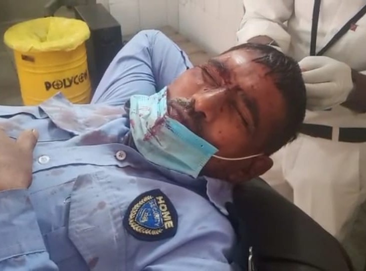 घायल गार्ड सीताराम। इसके सिर पर बदमाशों ने हथियार से हमला कर दिया।