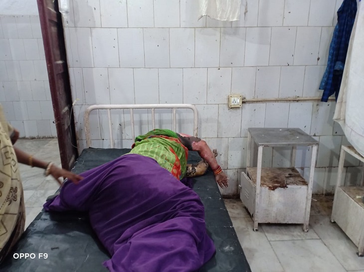 अस्पताल में भर्ती महिला।