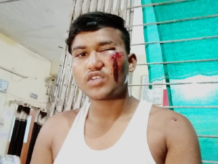 मारपीट में घायल हुआ छात्र प्रकाश। - Dainik Bhaskar