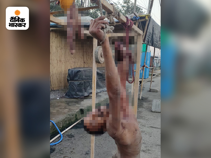 युवक को 100 मीटर तक घसीटा गया था। पांचों उंगलियों के साथ पूरी हथेली काटकर अलग कर दी गई।