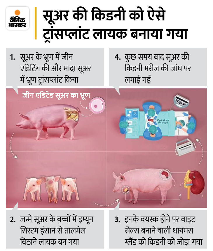 First Pig Pig Kidney Vs Human Kidney | World's First Pig Kidney Transplant Into Human