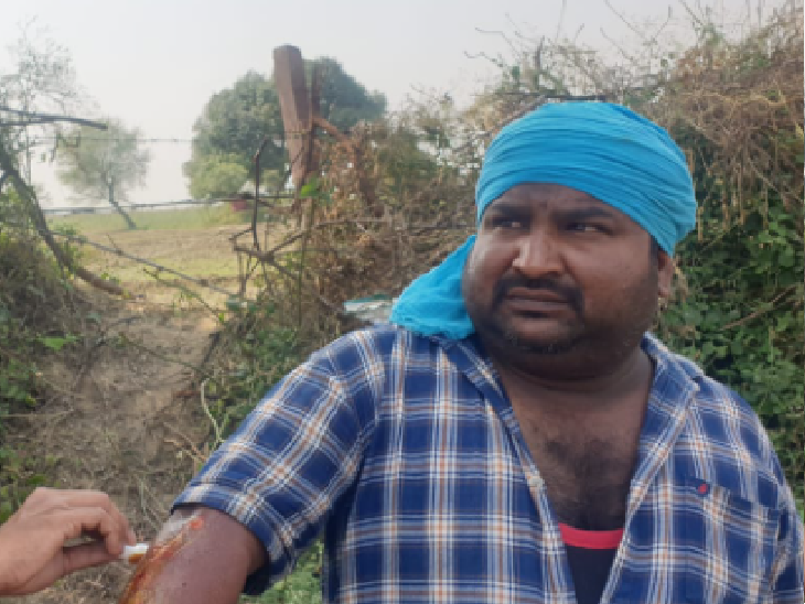 लूट की घटना से पीड़ित मैनेजर दीपक दौहरे।