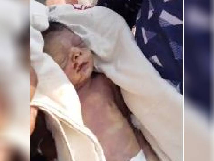 अस्पताल में इस मासूम का शव झुलस गया। बच्चे के शव का पीएम तक नहीं हो सका। बच्चे की मौत का कारण भी स्पष्ट नहीं किया गया।