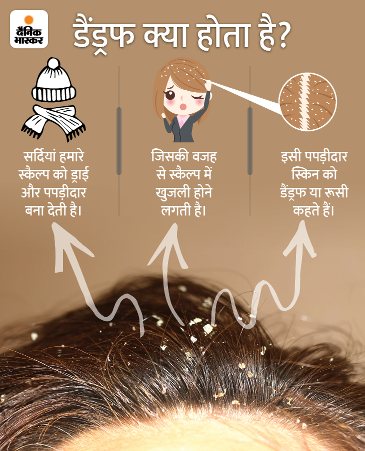 Winter Dandruff Reasons; What Causes, How to Remove It, and Tips In Hindi जरूरत की खबर