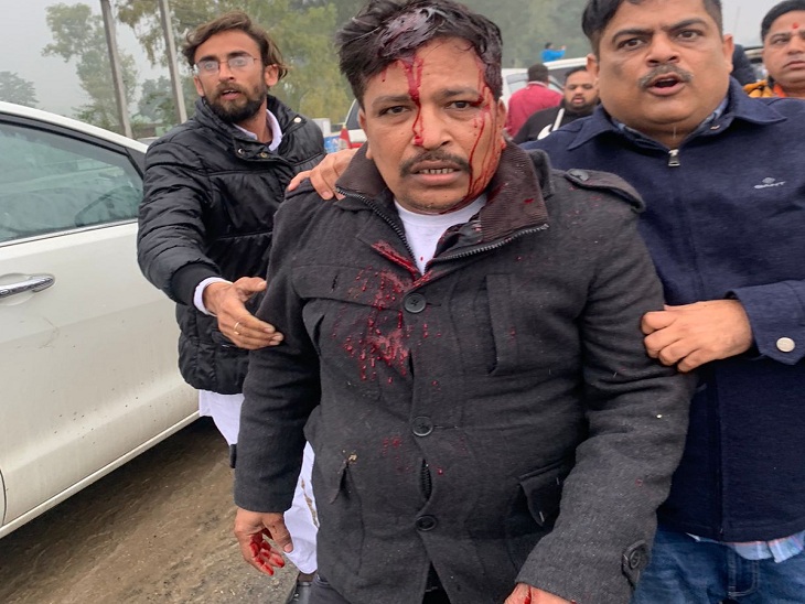 पुलिस ने दोनों को विरोध खत्म करने के लिए कहा। लेकिन कोई माना नहीं। मामला इस हद तक बढ़ गया कि दोनों में नारेबाजी करते हुए मारपीट तक की नौबत आ गई। पुलिस ने भाजपा कार्यकर्ताओं और किसानों को अलग-अलग की कोशिश की लेकिन जब हाथ से मामला निकलता देखा तो दोनों पर जमकर लाठियां बरसाई।