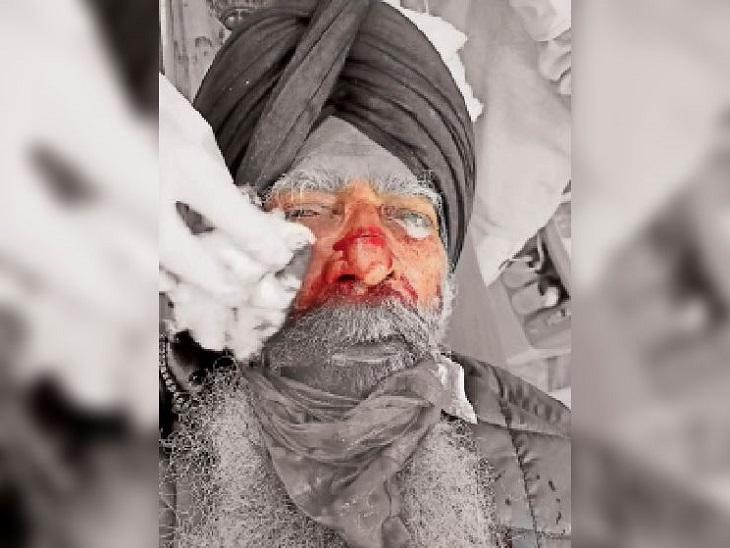 चाइनीज डोर के कारण घायल हुए व्यक्ति की फाइल फोटो